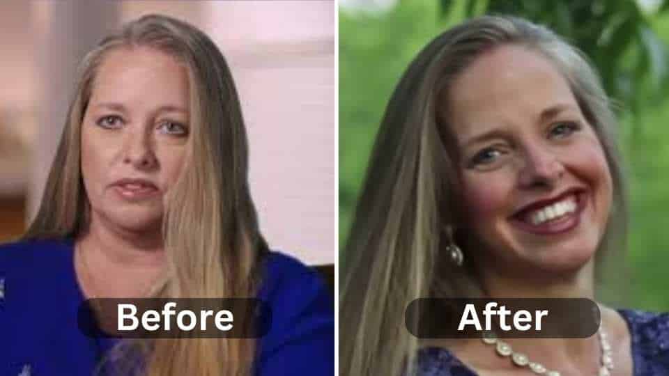 Kim Plath Weight Loss: Diet, Workout, Surgery and Before After