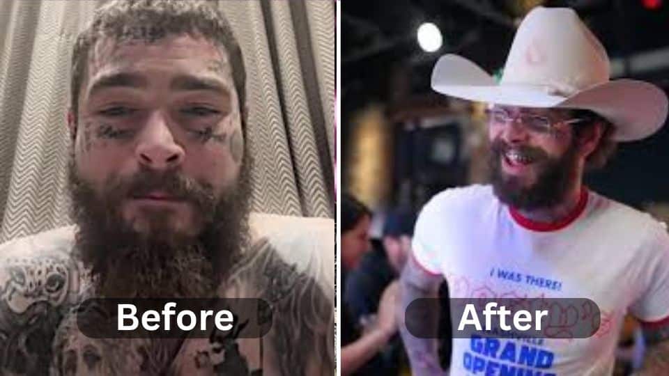 Post Malone Weight Loss: Diet, Workout, Before After & surgery