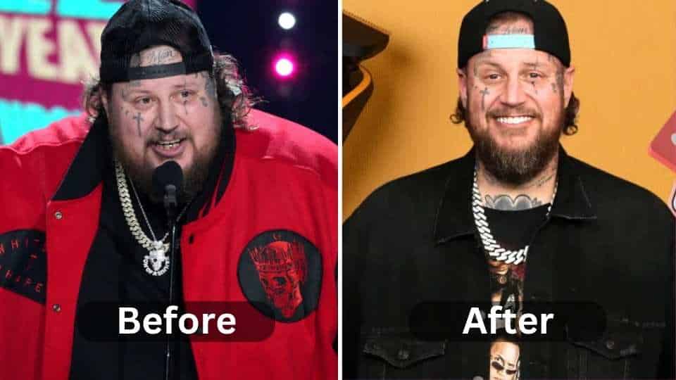 Jelly Roll Weight Loss Before After