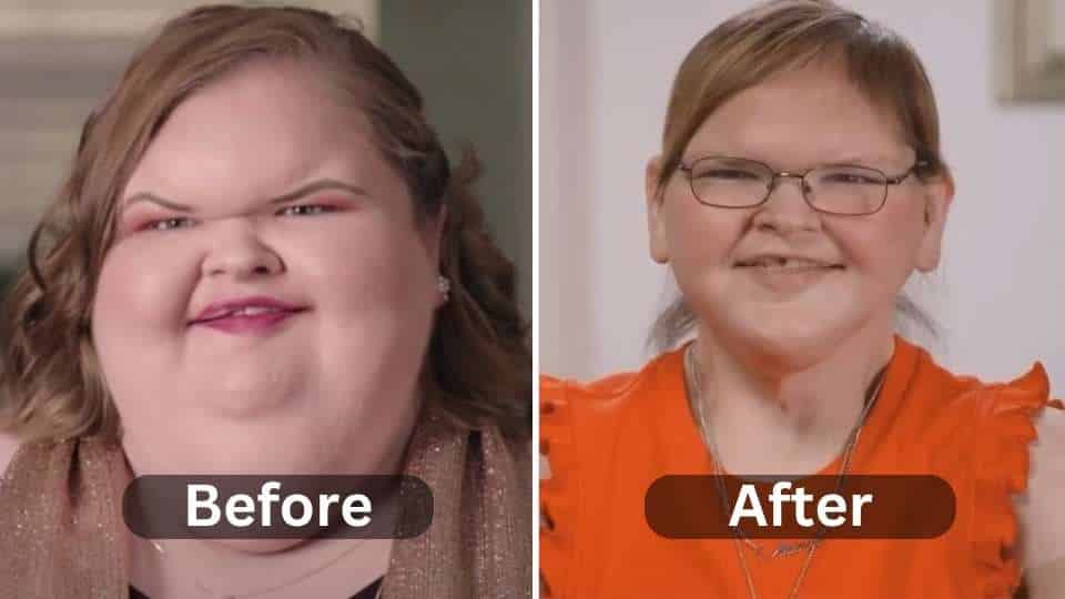 Tammy Slaton Weight Loss before after